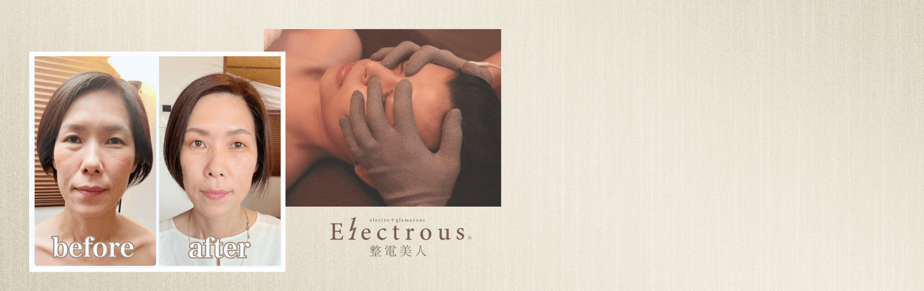 福岡の痩身エステ・整電美人エステ。40代50代のたるみ・自律神経の乱れ・疲労感を整える生体電流ナノカレント頭活ヘッド小顔リフトアップ施術のビフォーアフター。