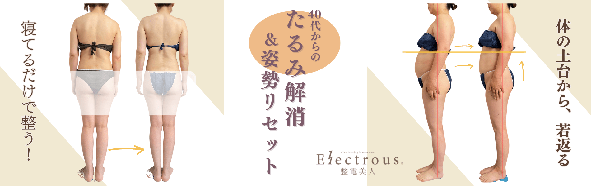 福岡の40代女性向け整電美人エステ。生体電流ナノカレントによる姿勢改善とたるみ解消のビフォーアフター画像。寝ているだけで整う施術で、全身のゆがみや下腹の変化がわかる姿勢リセットの結果写真。
