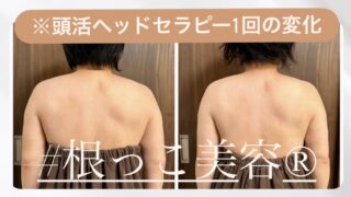 頭活ヘッドセラピー1回の施術による肩こり改善のビフォーアフター（40代女性）