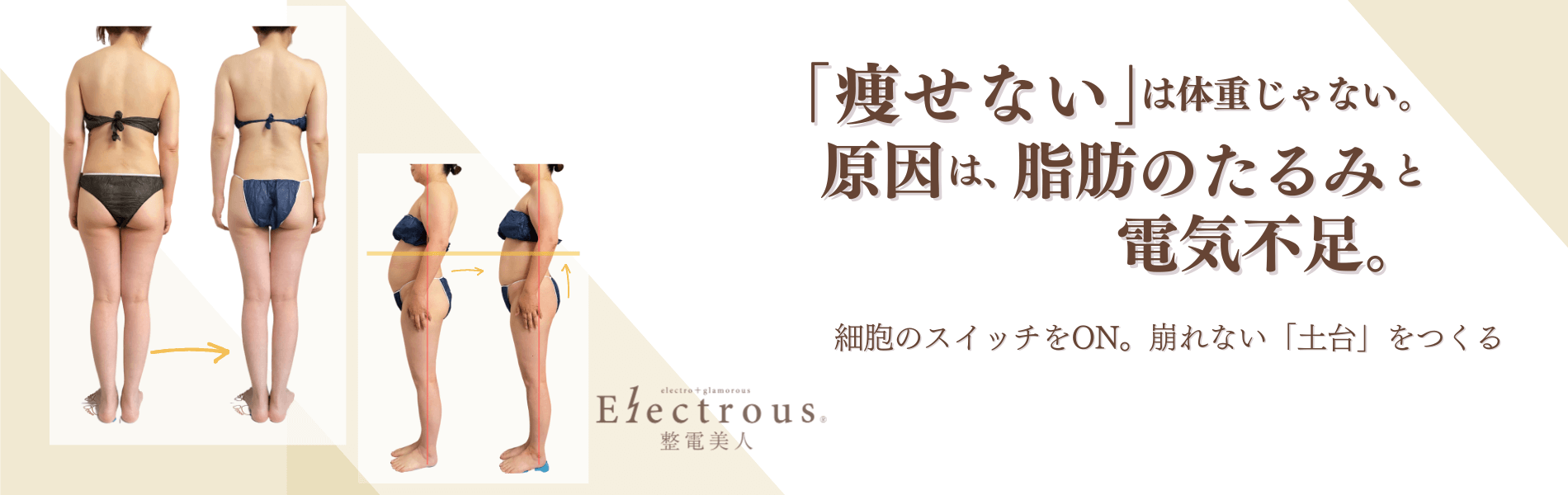 福岡の40代女性向け整電美人エステ。生体電流ナノカレントによる姿勢改善とたるみ解消のビフォーアフター画像。寝ているだけで整う施術で、全身のゆがみや下腹の変化がわかる姿勢リセットの結果写真。